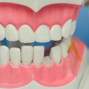 Dental Emergency in Toronto: 4 Common Emergencies to Look Out For Dental Emergency in Toronto: 4 Common Emergencies to Look Out For