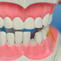 Dental Emergency in Toronto: 4 Common Emergencies to Look Out For