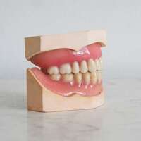 How to Mentally Prepare for Dental Implant Surgery