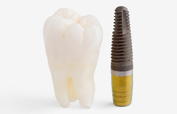 Dental Emergencies