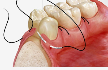 Dental Emergencies